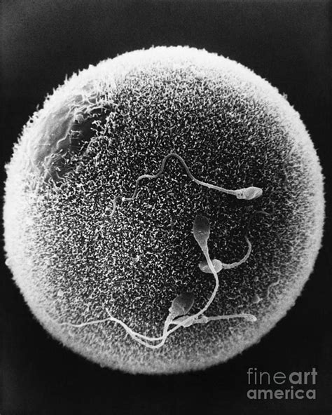 the egg sem company|The Egg .